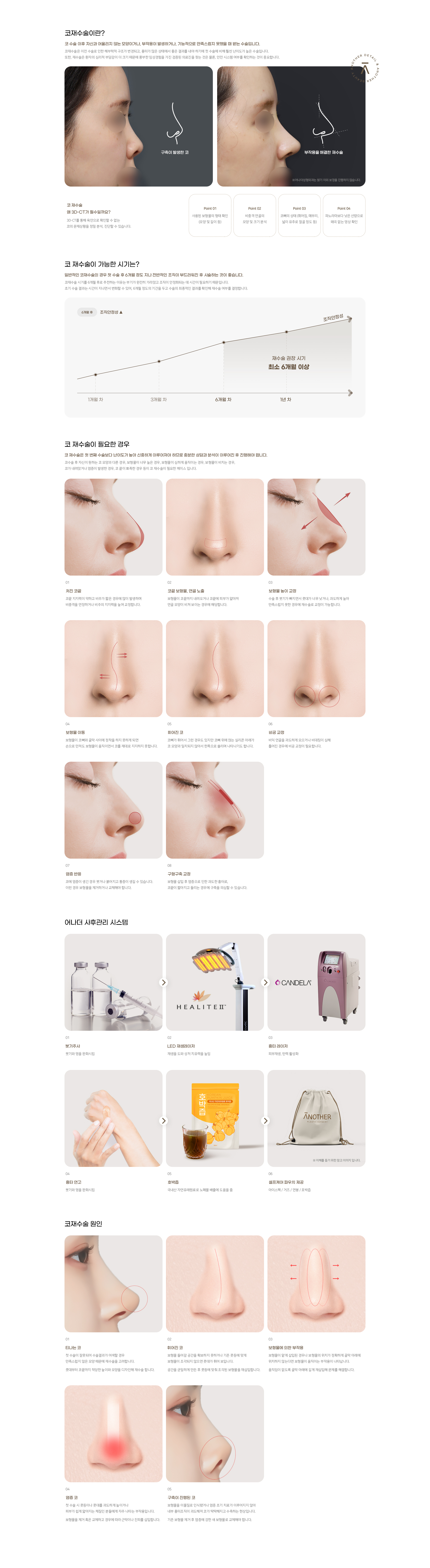 코 재수술