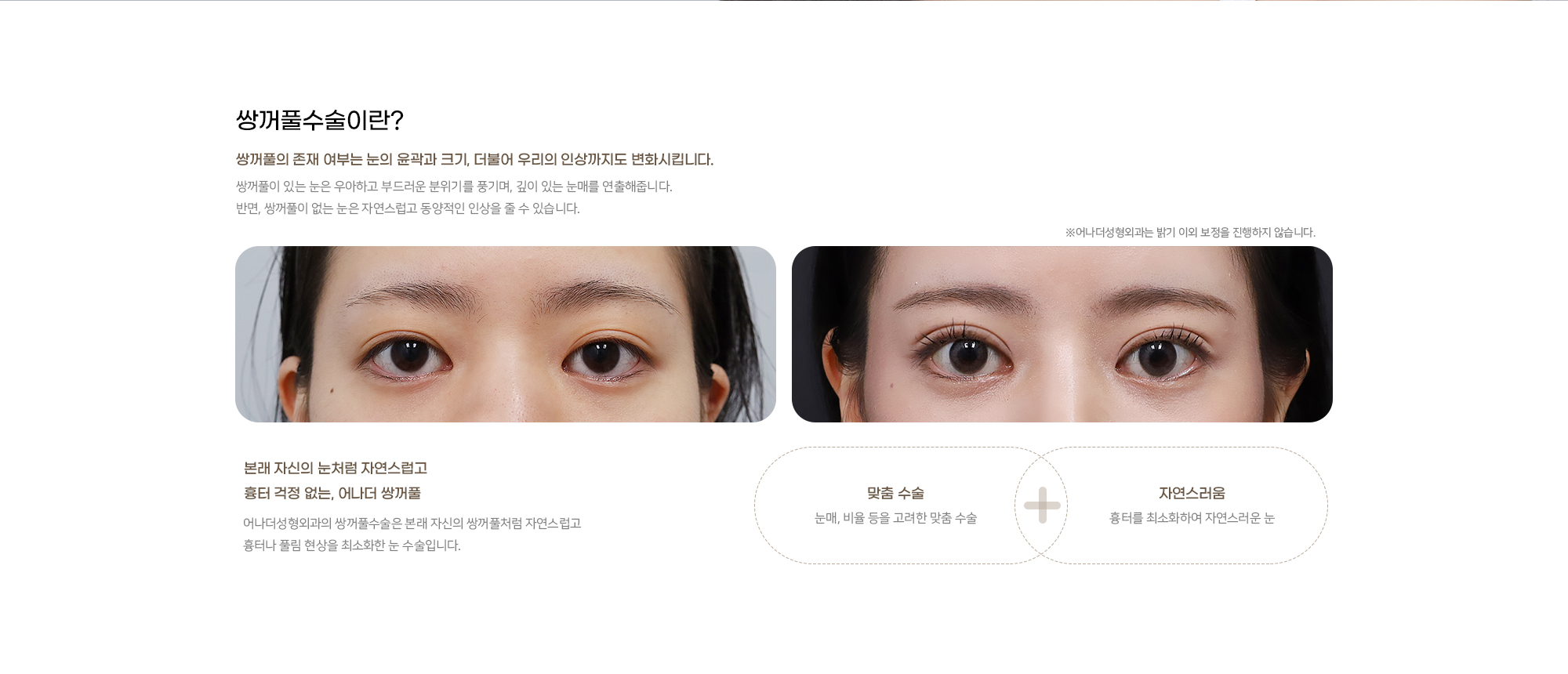 쌍꺼풀
