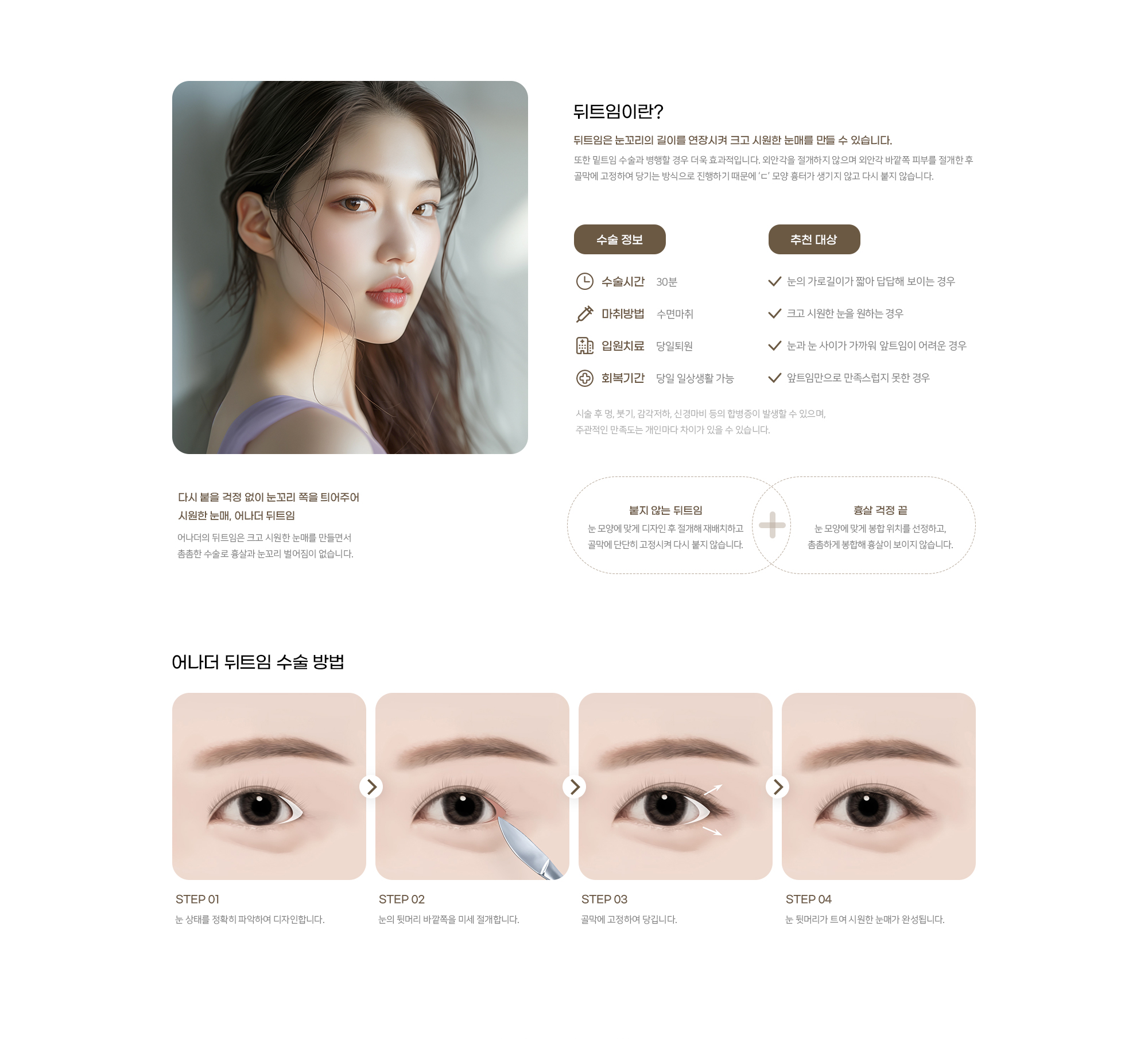어나더성형외과 뒤트임