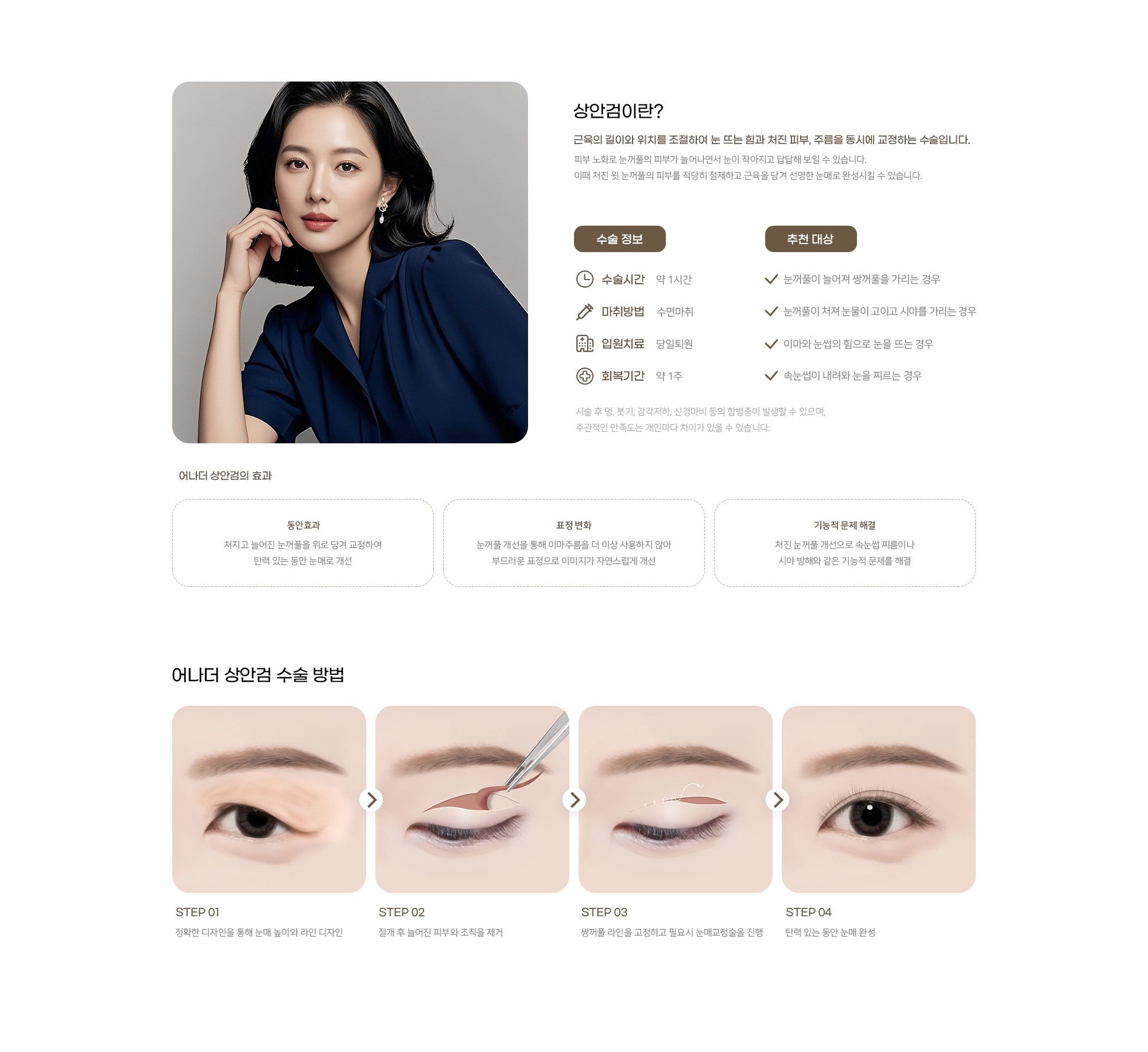 어나더성형외과 상안검 수술