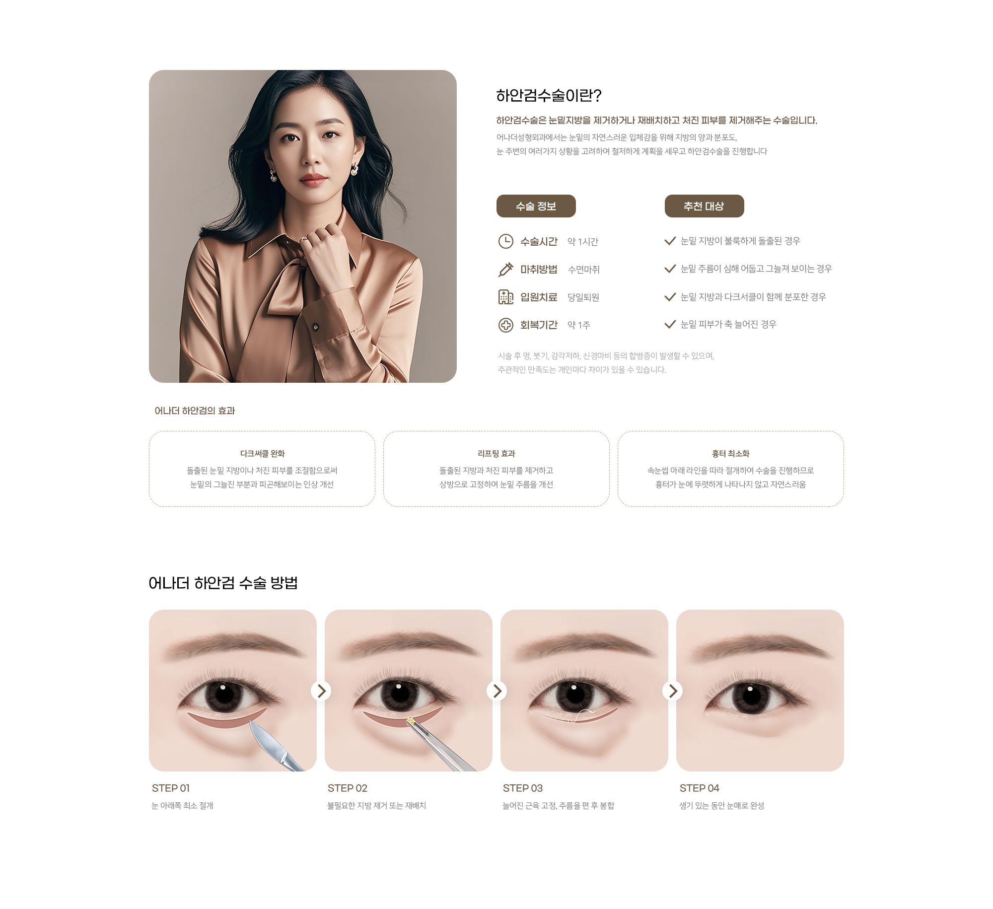 어나더성형외과 하안검 수술